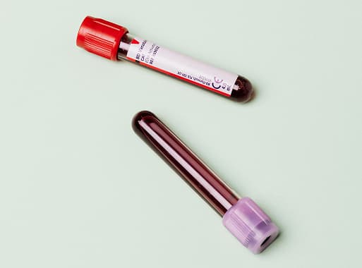 Pregnancy-related blood tests